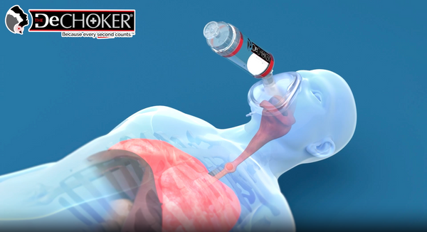 Dechoker : Explosion de la conversion grâce à l'expertise de notre agence Shopify